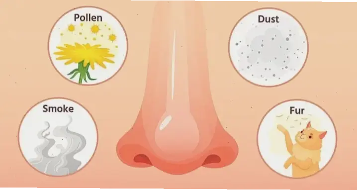 Nguyên nhân và triệu chứng của viêm mũi dị ứng