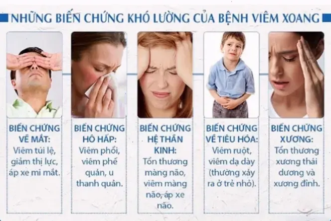 Nguyên nhân và triệu chứng của viêm mũi mãn tính