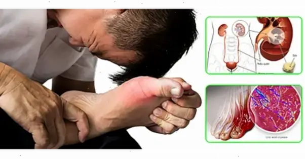 Nguyên nhân và triệu chứng