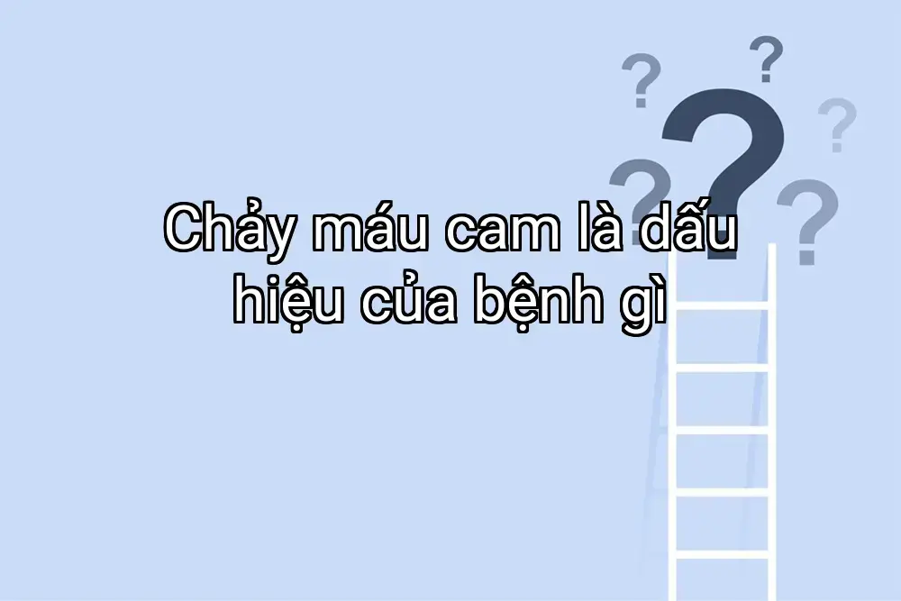 Chảy máu cam là dấu hiệu của bệnh gì