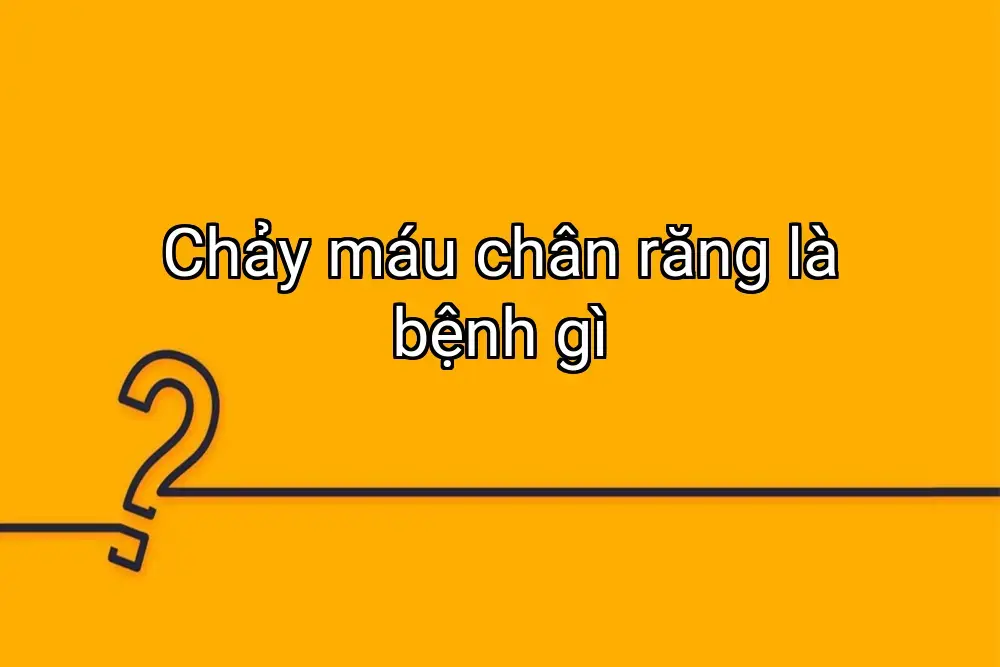 Chảy máu chân răng là bệnh gì