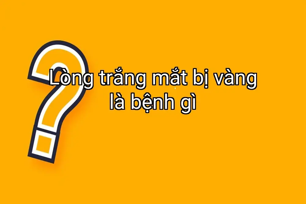 Lòng trắng mắt bị vàng là bệnh gì
