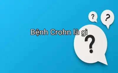Bệnh Crohn là gì