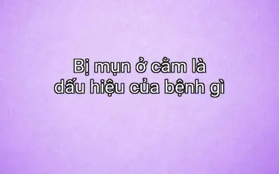 Bị mụn ở cằm là dấu hiệu của bệnh gì