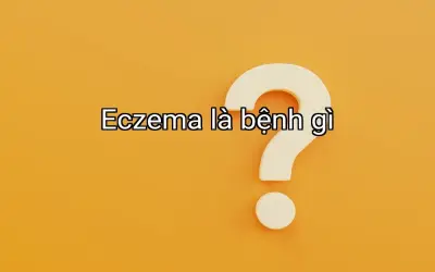 Eczema là bệnh gì