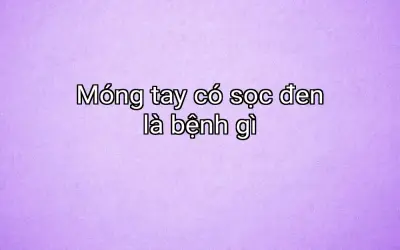 Móng tay có sọc đen là bệnh gì