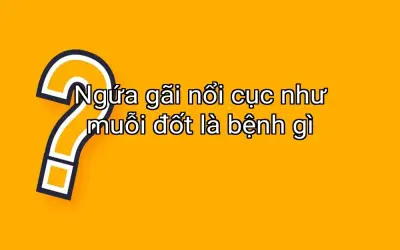 Ngứa gãi nổi cục như muỗi đốt là bệnh gì