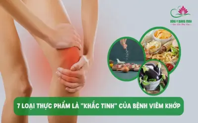 Thực phẩm hàng đầu giúp giảm viêm khớp cổ mãn tính ngay!