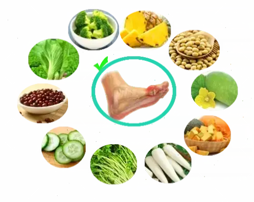 Thực phẩm lý tưởng cho bệnh gout mãn tính: Khám phá ngay!