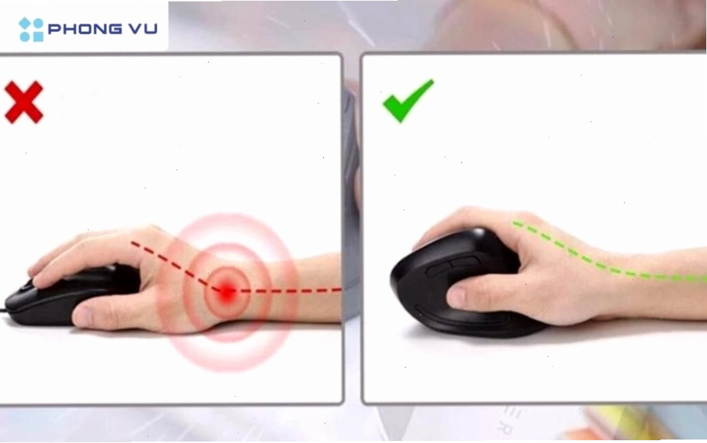 Chuột công thái học là một loại chuột máy tính được thiết kế đặc biệt nhằm tối ưu hóa tư thế làm việc
